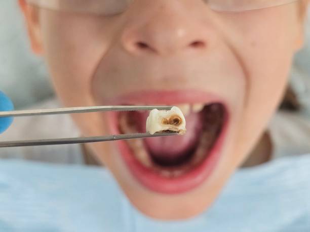 Best Emergency Dentist for Special Needs Patients in Ennis, TX