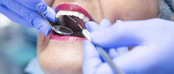 Best Emergency Dental Extractions in Ennis, TX